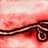 Ebola