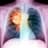 LungCancer