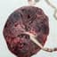 Placenta Pattie